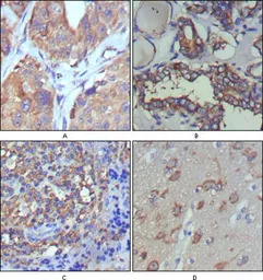 Wnt5a antibody [6F2]