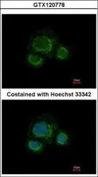 CHST7 antibody [N2C1], Interna