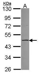 CCM2 antibody [N1C2]