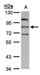 ALOXE3 antibody [N1N3]