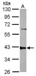 PPP2R4 antibody