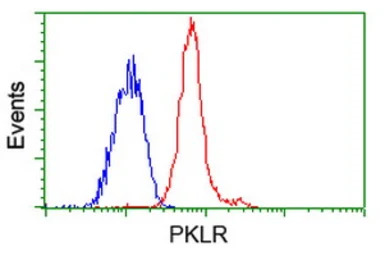 Pyruvate Kinase (liver/RBC) an