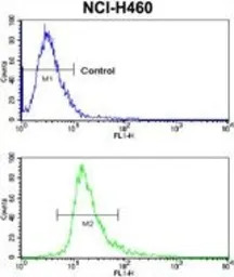 Coxsackie Adenovirus Receptor 