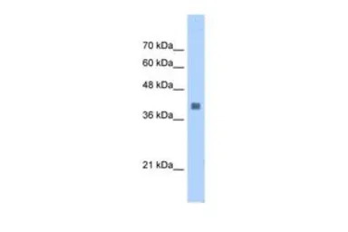 Aldolase A antibody, N-term