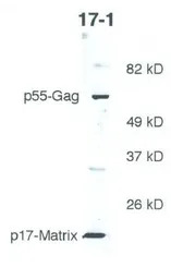 HIV1 P17 Gag antibody [17-1]