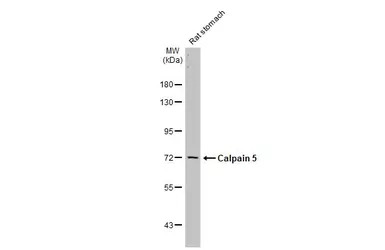 Calpain 5 antibody [N1C1]