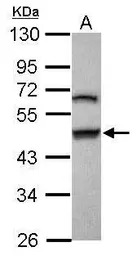 Gasdermin B antibody [N1C1]