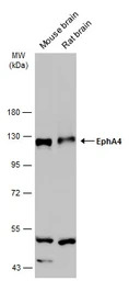 EphA4 antibody [N3C2-2], Inter