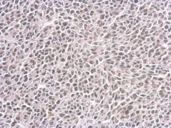 CENPF antibody [14C10 1D8]