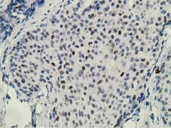 ZIM2 antibody [5E12]