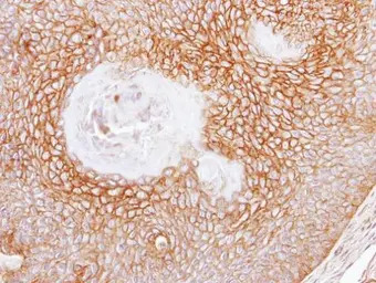 CD105 antibody [N3C3]