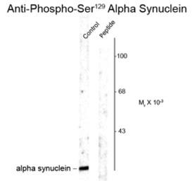 alpha Synuclein (phospho Ser12