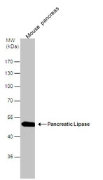 Pancreatic Lipase antibody [N3