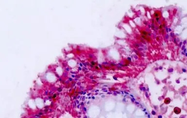 NPFF2 receptor antibody