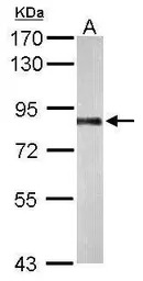 PNPase antibody