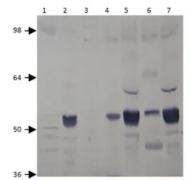 PDE7A antibody