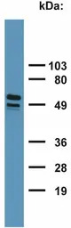 Cytokeratin 7 + 17 antibody [C