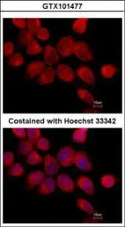 Transketolase antibody [N3C2],