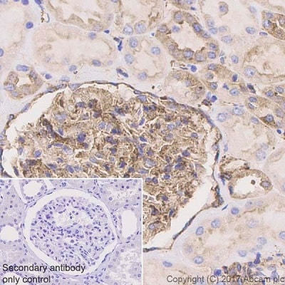 【VAMP2】人小突触泡蛋白2抗体，Anti-VAMP2抗体