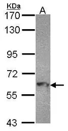 MTMR9 antibody [C3], C-term