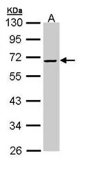 Alpha 2 Antiplasmin antibody [