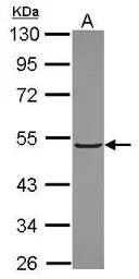KLHL3 antibody [N1C1]