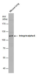 Integrin alpha 6 antibody [N3C