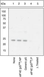 eIF4E (phospho Ser209) antibod