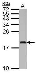 MMS2 antibody