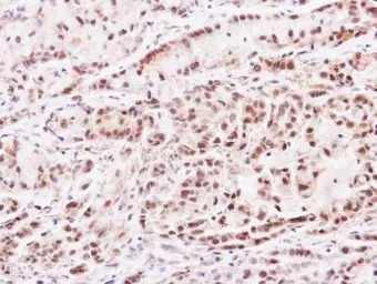 PRMT2 antibody [N1C2]