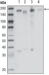 RON antibody [1B5A9]