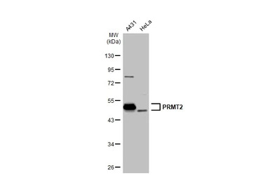 PRMT2 antibody [N1C2]