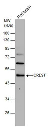 CREST antibody [C1C3]