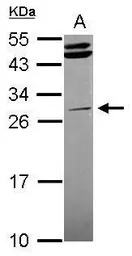 STK16 antibody [N1C3-2]