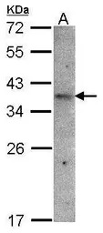 GPR164 antibody [N2C1], Intern