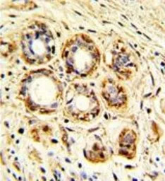 Cathepsin K antibody, Internal