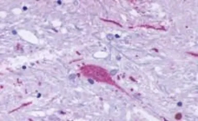 TM7SF1/GPR137B antibody