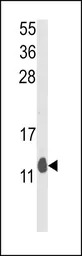 PEA15 antibody, C-term