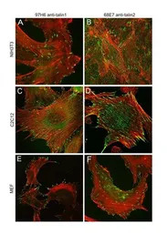 Talin-1 antibody [97H6]