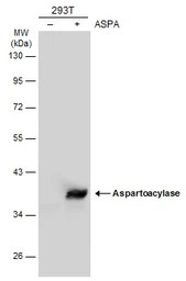 Aspartoacylase antibody [N1C3-