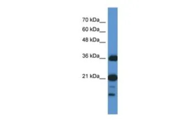 C1orf144 antibody, N-term