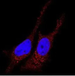 LC3B antibody