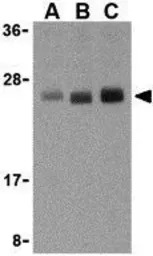 TL1A antibody
