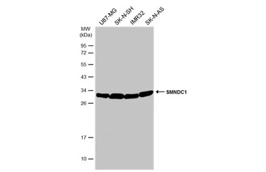 SMNDC1 antibody [N1C3-2]