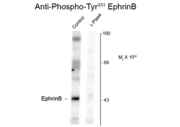 Ephrin B1 (phospho Tyr344) ant