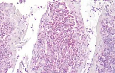 Leukotriene B4 Receptor antibo
