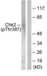 Chk2 (phospho Thr387) antibody