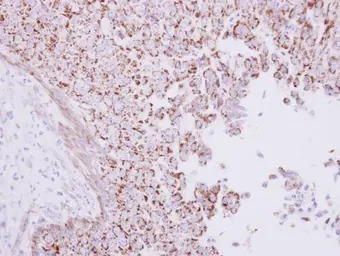 CD168 / RHAMM antibody [N1N2],