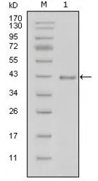 Laminin beta 1 antibody [2D9G5
