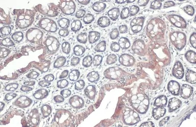 GSPT1 antibody